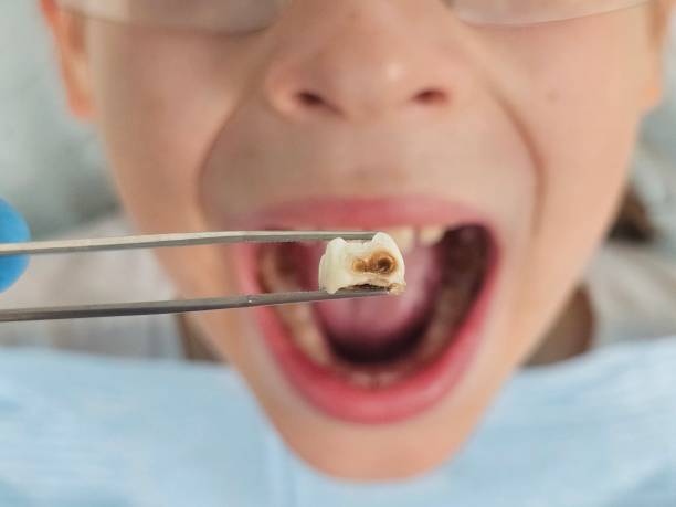 Best Weekend Emergency Dentist in Port Reading, NJ